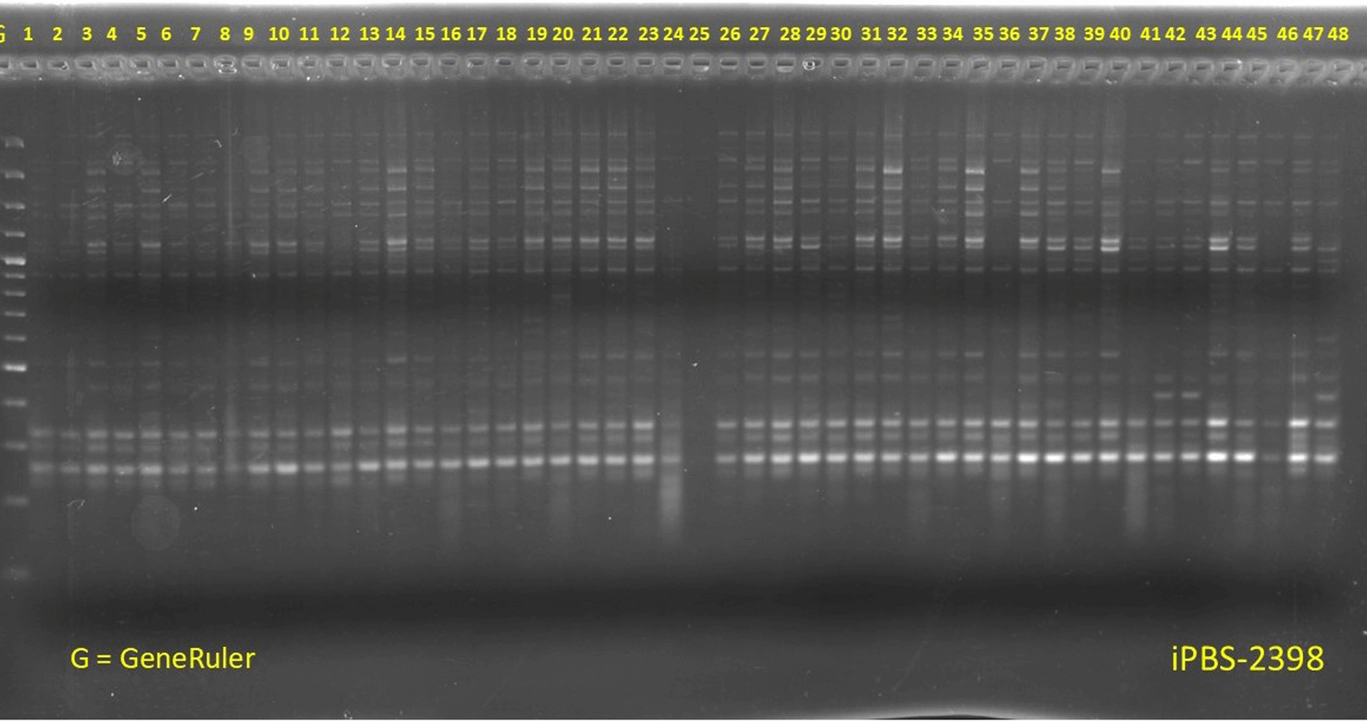 Revealing the genetic diversity and population structure in lentil (Lens culinaris) germplasm using inter-primer binding site (iPBS)-retrotransposon markers | BMC Plant Biology