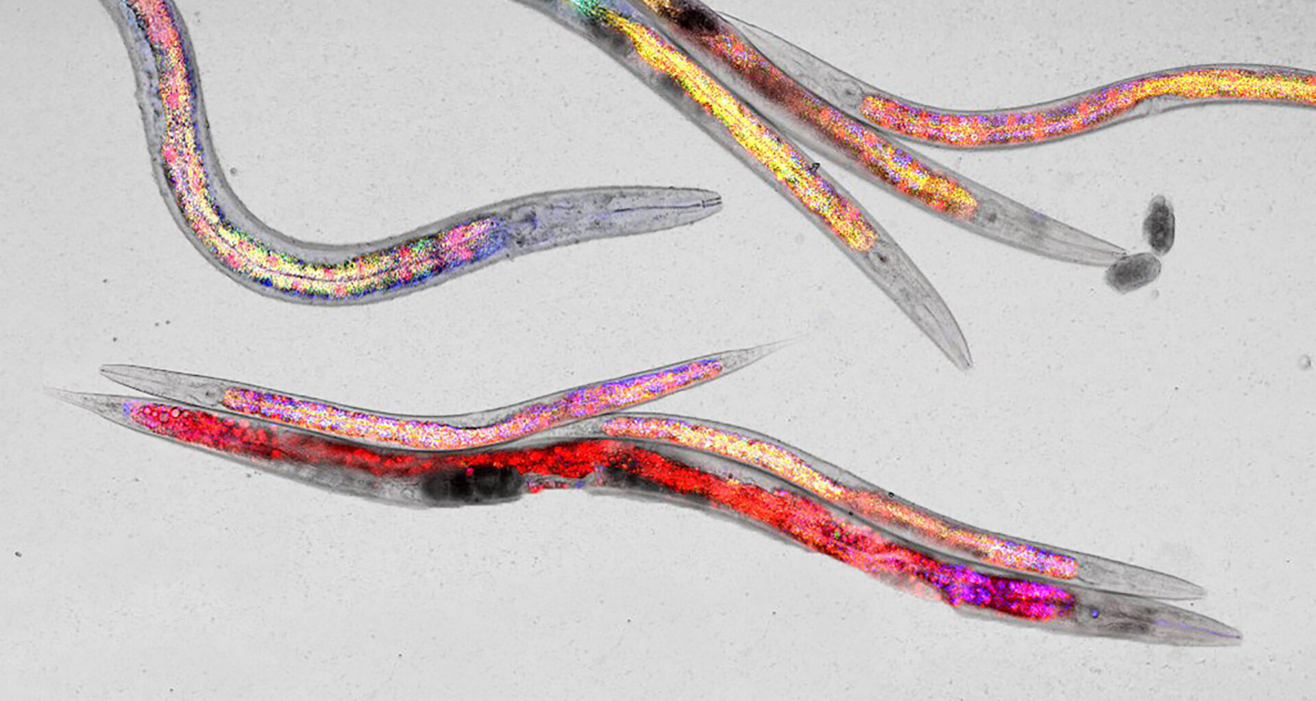 Dietary stress supports healthy aging