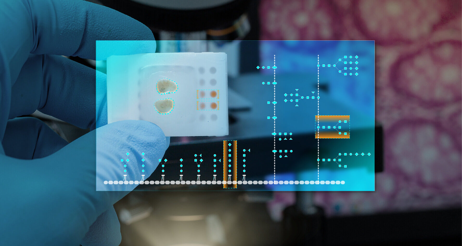Glycan genes open diagnostic opportunities