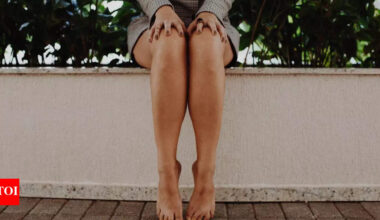 Your legs and feet can reveal more about your health than you think, says doctor |