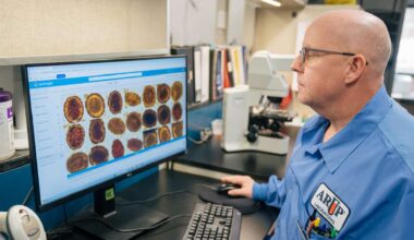 Utah study shows AI can quickly and accurately detect parasites in stool samples