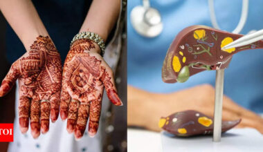 Henna can reverse liver damage: Japanese scientists reveal how a natural plant dye may help reverse fibrosis and repair the liver |