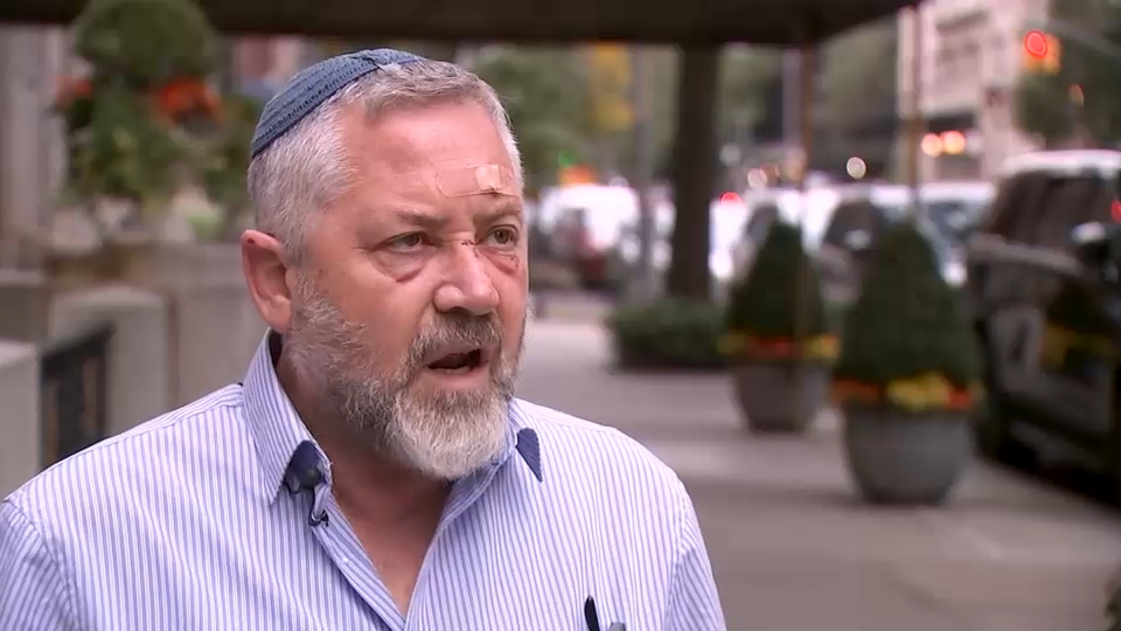 Midtown tourist attacked: Rabbi from Jerusalem sucker punched during first visit to NYC