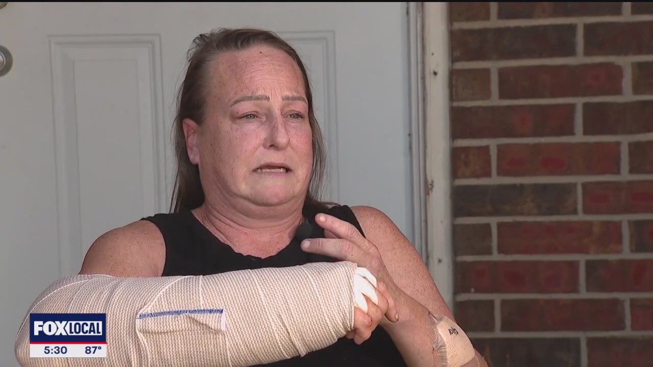 PREVIOUS COVERAGE: Dog attack victim recovers as police search for owner