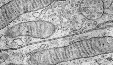 Long, narrow mitochondria with visible cristae shown under electron microscopy at 28000x magnification