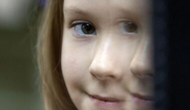 Rare genetic mutation that brings threat of brain bleeding unusually common in New Mexico | Local News