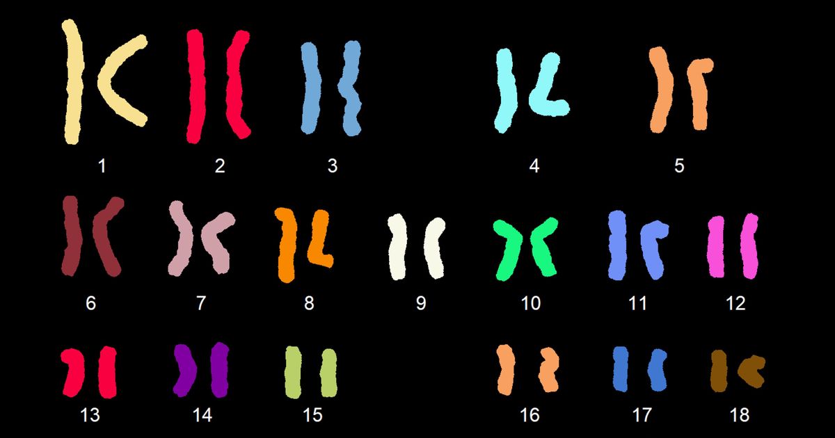 A genetic anomaly linked to infertility was a puzzle. Scientists solved it.