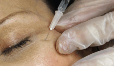 Two Louisiana residents hospitalized after counterfeit Botox | Health care/Hospitals