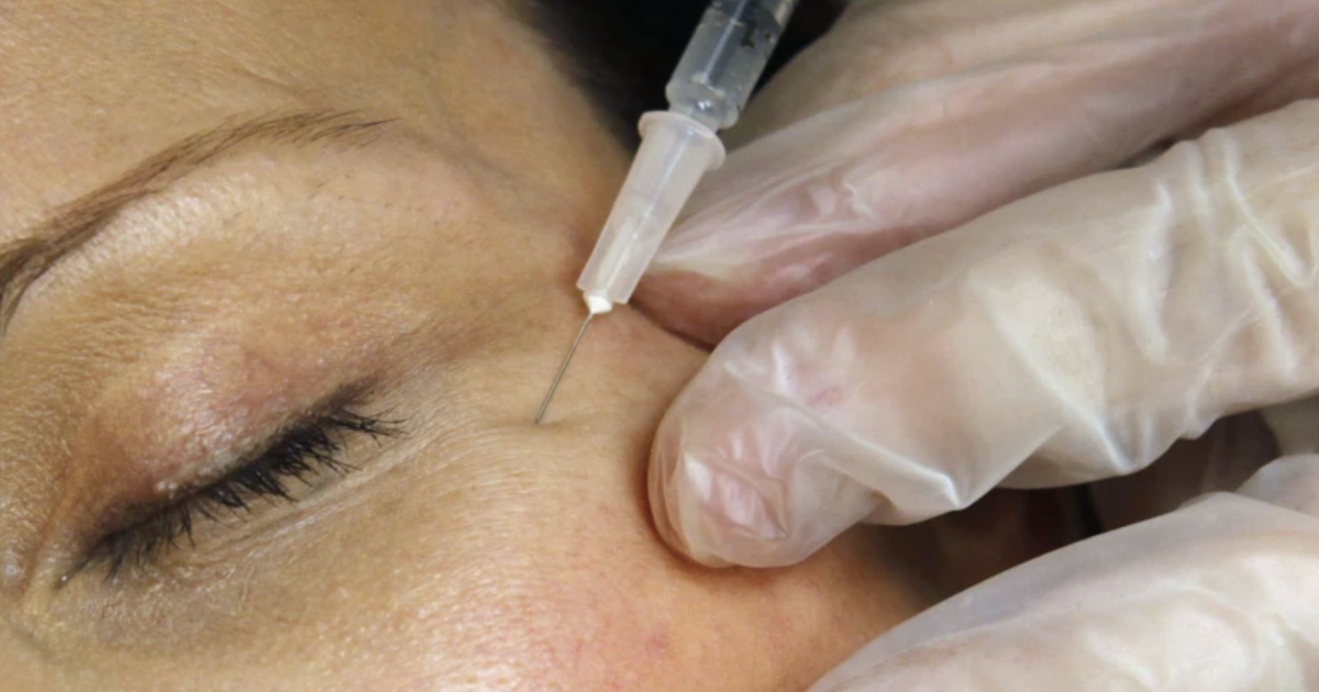 Two Louisiana residents hospitalized after counterfeit Botox | Health care/Hospitals