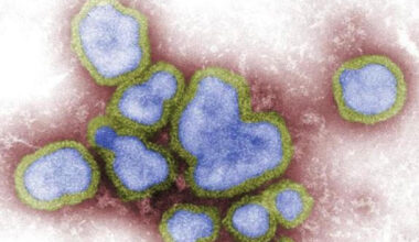 Mexico reports new human case of H5 bird flu