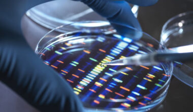 Newswise: Research Tip Sheet: Genetic Misfire in Lupus, UTI-Related Delirium
