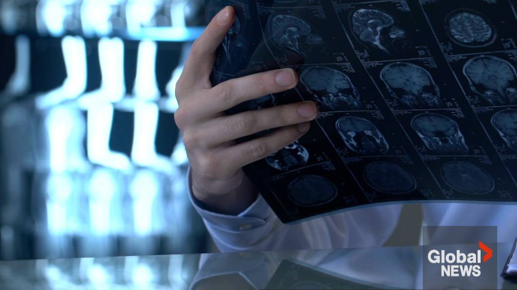 Click to play video: 'New blood test could be a game changer for those living with Alzheimer’s disease'