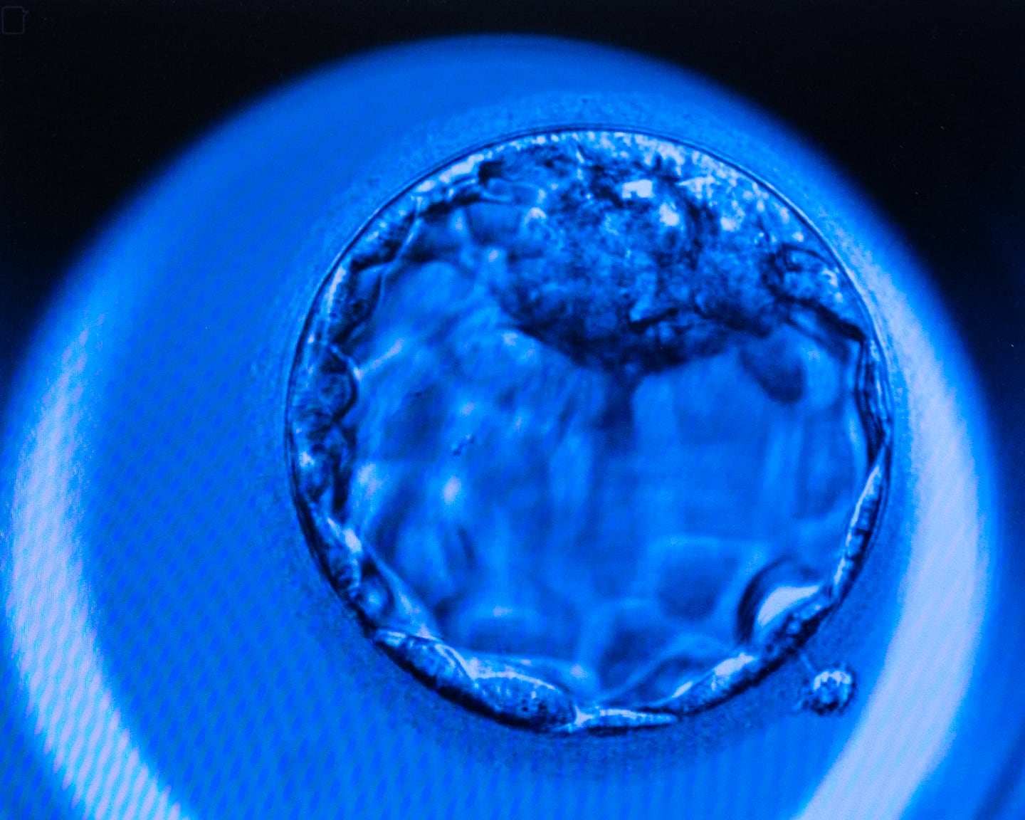 A 5-day-old embryo, as viewed by technicians in Omaha.