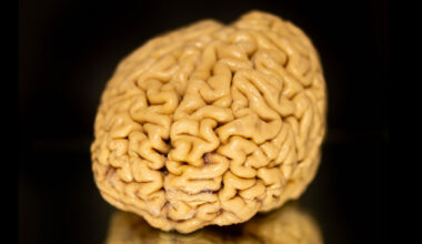 'Superager' Brains Defy Cognitive Decline. We Finally Know Their Secret. : ScienceAlert