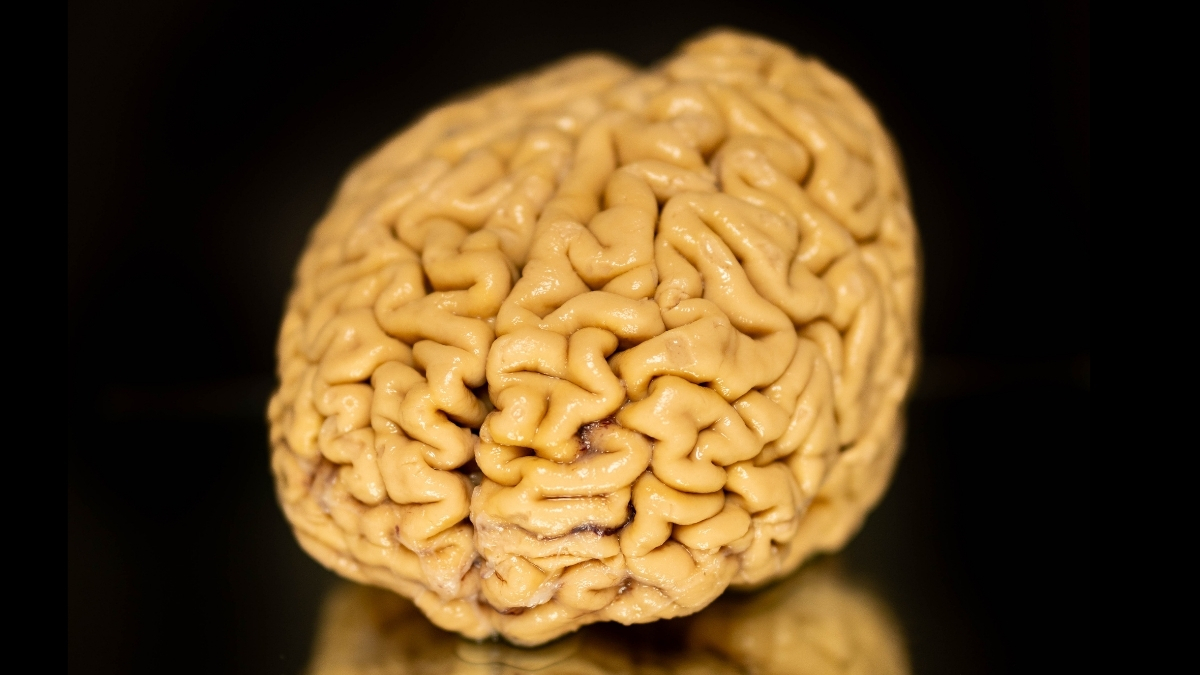 'Superager' Brains Defy Cognitive Decline. We Finally Know Their Secret. : ScienceAlert