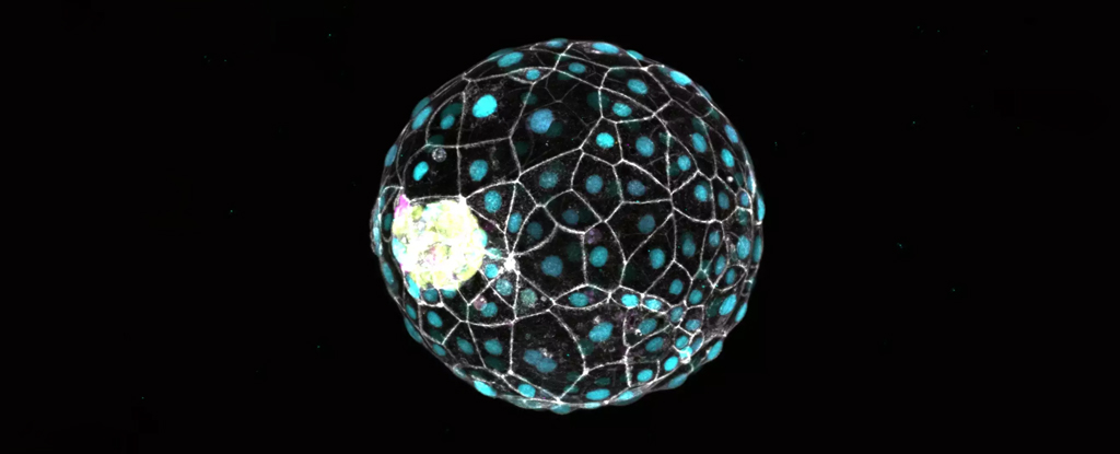 An Ancient Infection May Play a Critical Role in Our First Moments of Life : ScienceAlert
