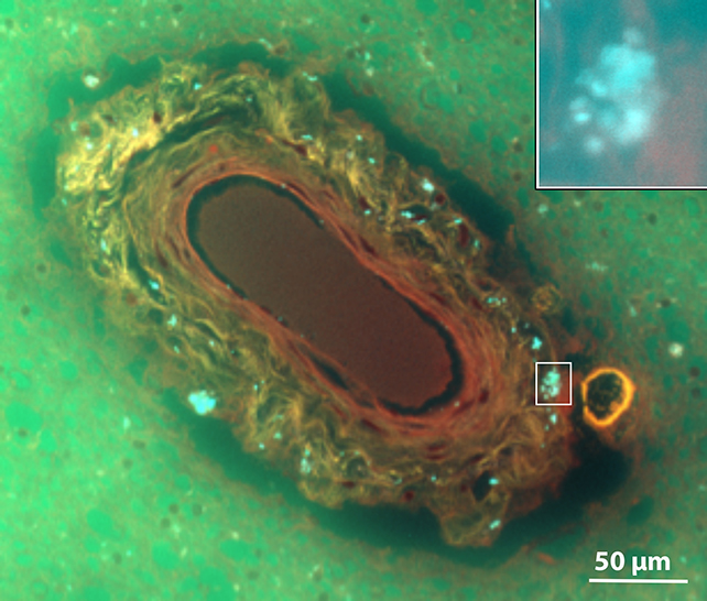 Blood vessel under a microscope