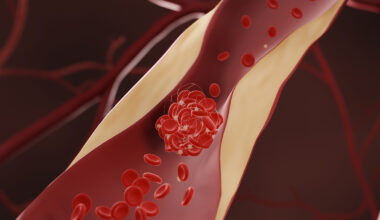 Drugs That Lower Cholesterol May Also Reduce Dementia Risk, Says Huge New Study : ScienceAlert