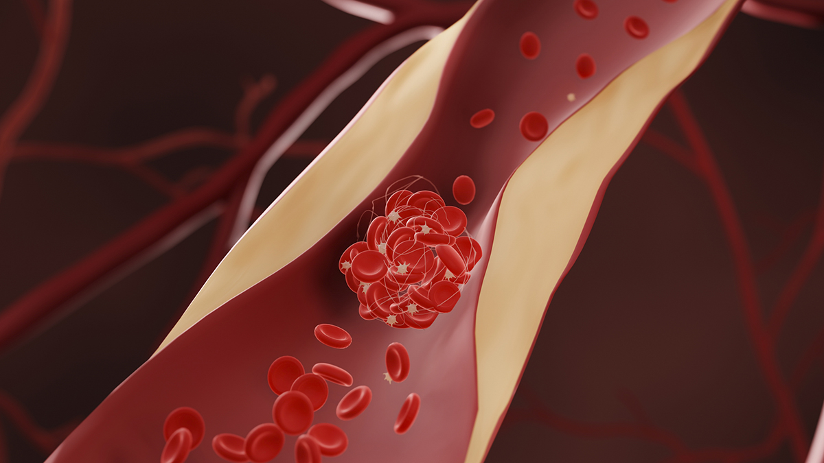 Drugs That Lower Cholesterol May Also Reduce Dementia Risk, Says Huge New Study : ScienceAlert