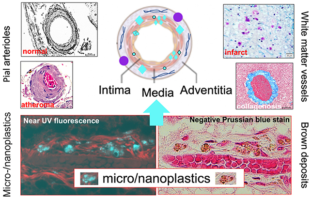 Blood vessel analysis