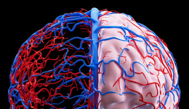 Microplastics May Be Tied to Vascular Dementia Cases, Review Finds : ScienceAlert