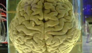 Op-Ed: Very big deal - Monash University major achievement with nanofluidic chip