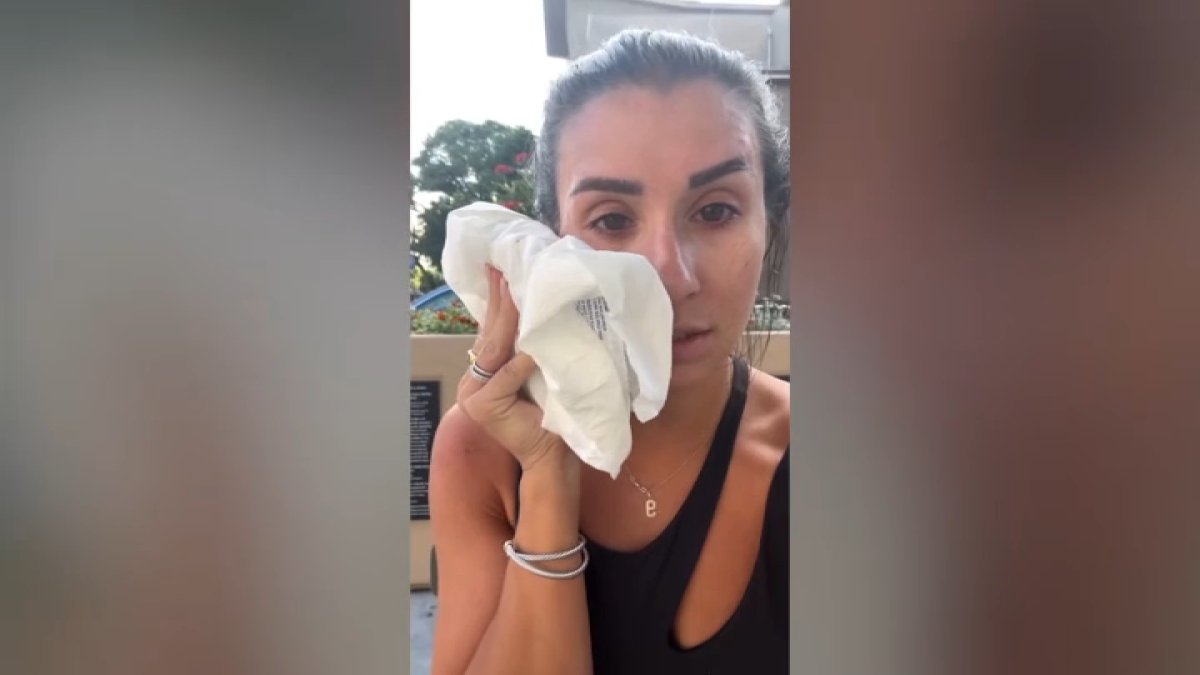 Stranger punches woman in the face in Little Italy – NBC 7 San Diego