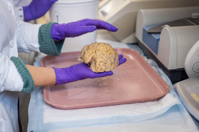 Donated superager brain being held in lab