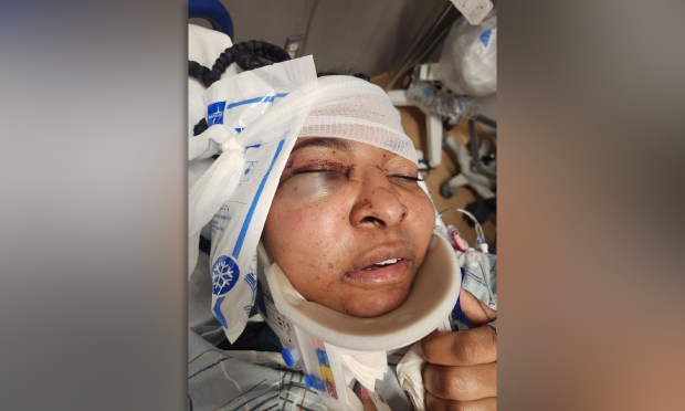 Corrections officer Shamika Mitchell suffered a fractured eye socket and other injuries and spent five days in intensive care.
