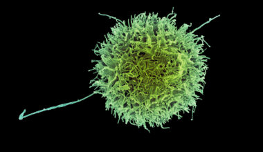 Engineered “natural killer” cells could help fight cancer | MIT News