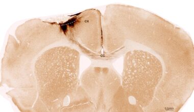 Mouse Brain After Stroke and Neural Stem Cell Transplantation