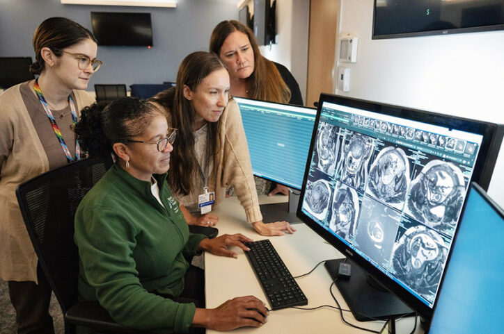 Four medical professionals gathered around large computer monitors examining brain scans.