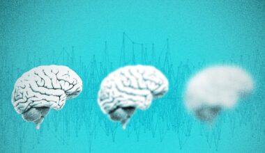 Increase in cognitive disability affects younger adults the most – Deseret News