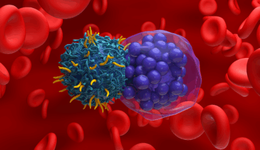 Researchers identify genetic markers that affect treatment outcomes in patients with large B-cell lymphoma