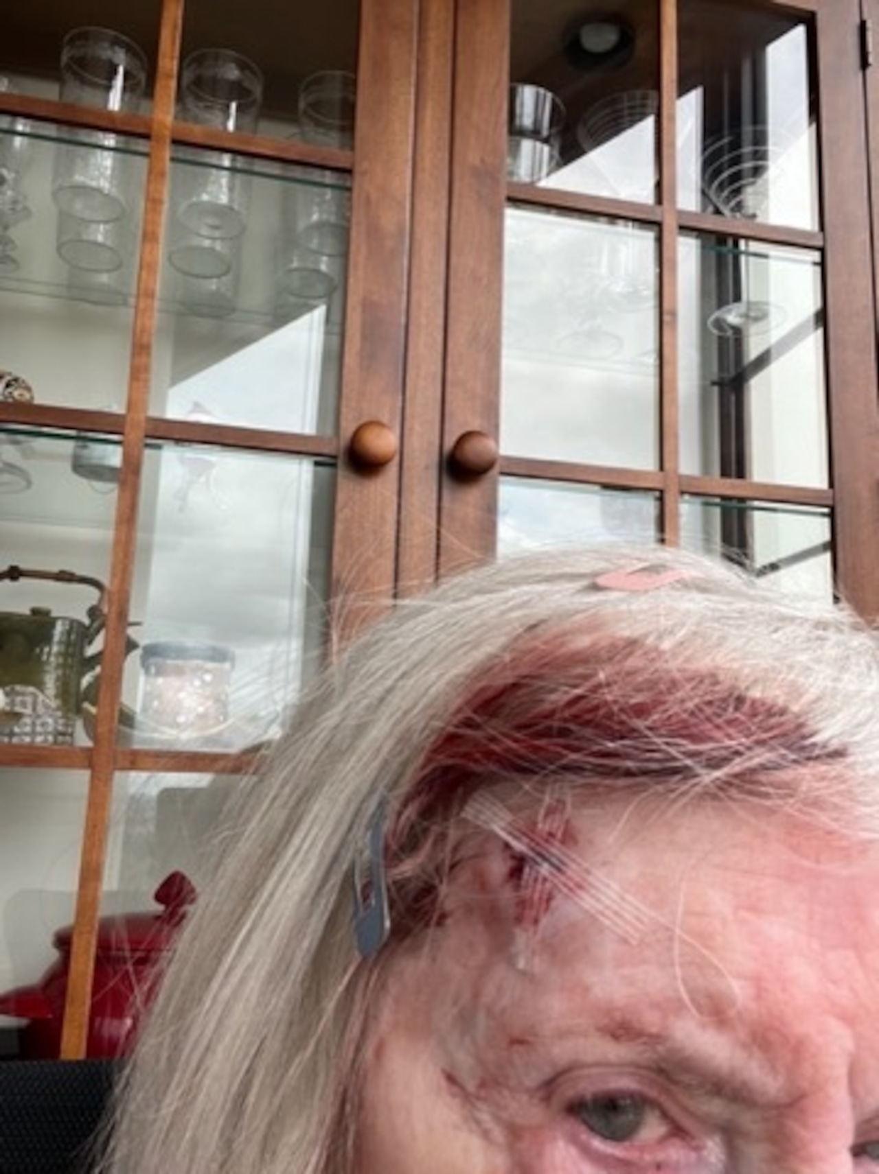 Federal agents knock down elderly couple