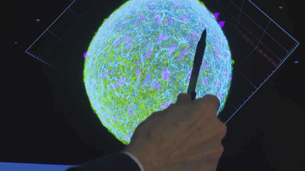 Click to play video: 'UBC researchers create mini human brains to study Alzheimer’s'