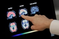 A doctor looks at PET brain scans at Banner Alzheimer's Institute in Phoenix on Aug. 14, 2018.