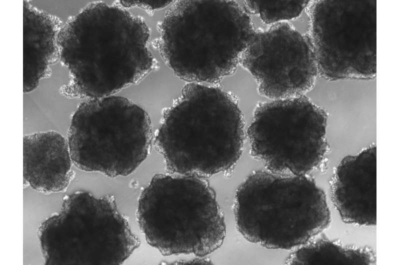 Ancient lead exposure shaped evolution of human brain