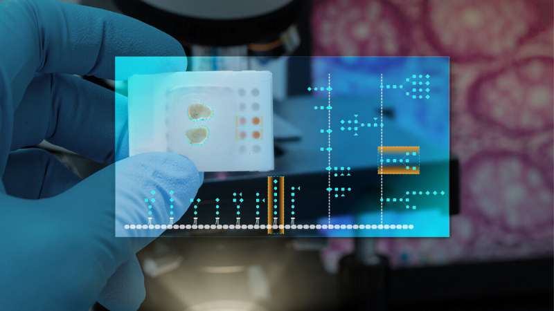 Cancer's hidden sugar code opens diagnostic opportunities