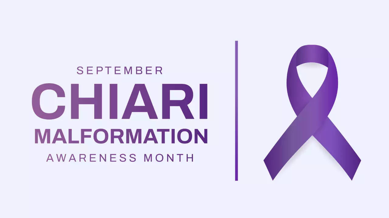 chiari malformation