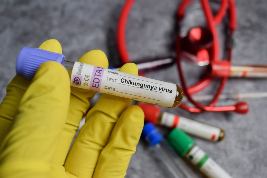 A New York resident has tested positive for the mosquito-borne chikungunya virus — marking the first locally transmitted case in the U.S. in six years, officials said Tuesday.
