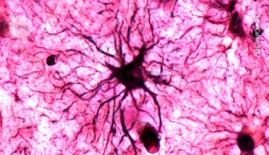 How emotional memories are engraved on the brain, with surprising helper cells