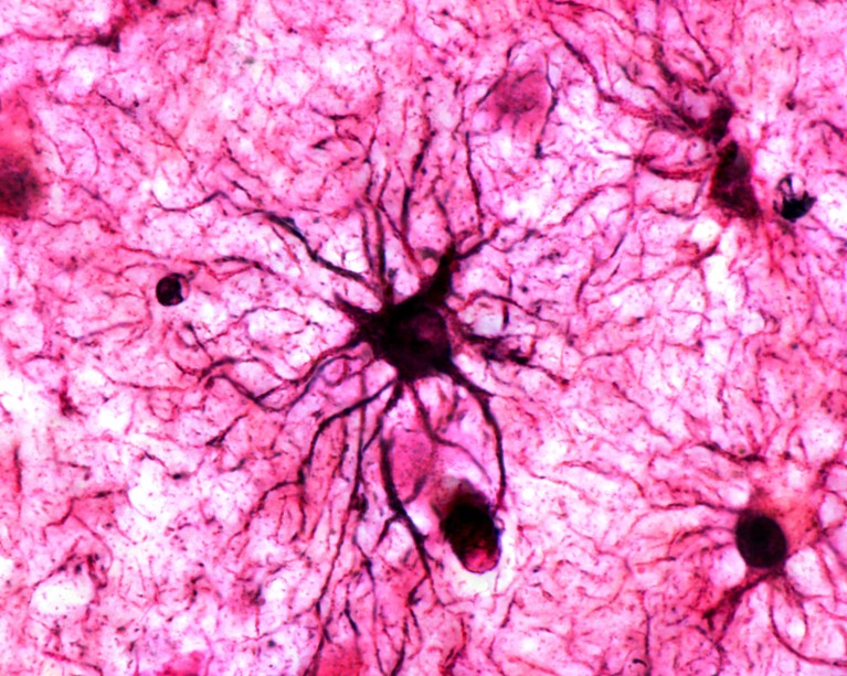 A light micrograph showing a protoplasmic astrocyte stained black on a pink background