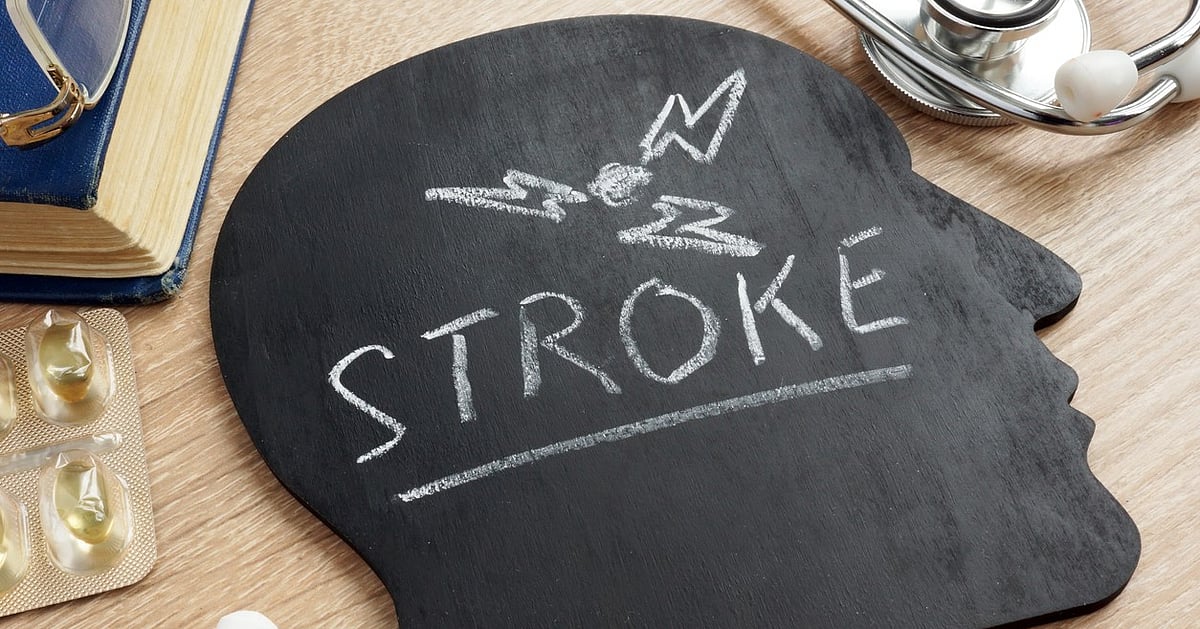Bengaluru: Doctors see increase in stroke cases among youngsters - Deccan Herald