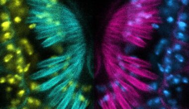 Brighter Side of News