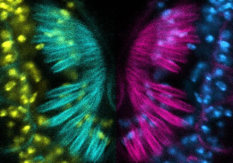 Brighter Side of News