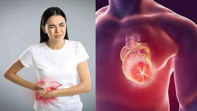 Heart diseases caused by fatty liver: Understanding the link between metabolic dysfunction and cardiovascular health