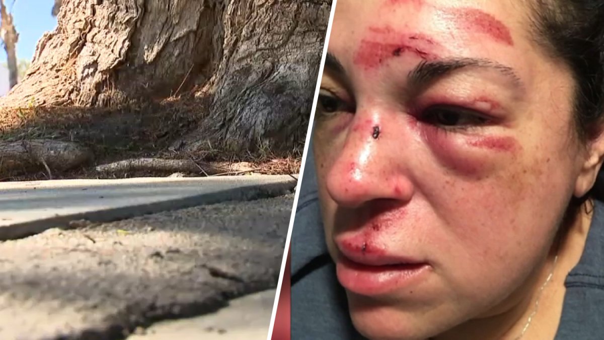 Whittier woman reaches $7.5M settlement after sidewalk fall – NBC Los Angeles
