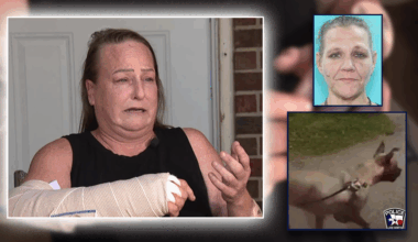 Dog Attack: Owner, boyfriend arrested after pit bull mauling hospitalizes victim