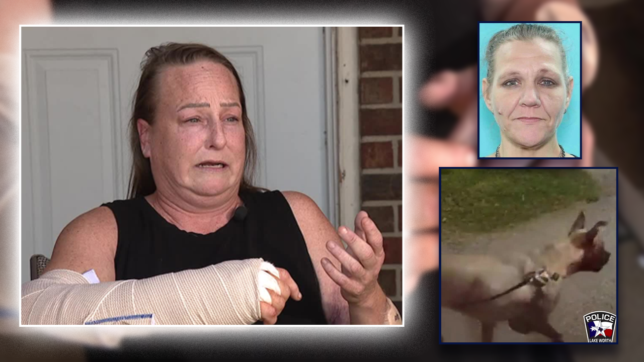 Dog Attack: Owner, boyfriend arrested after pit bull mauling hospitalizes victim